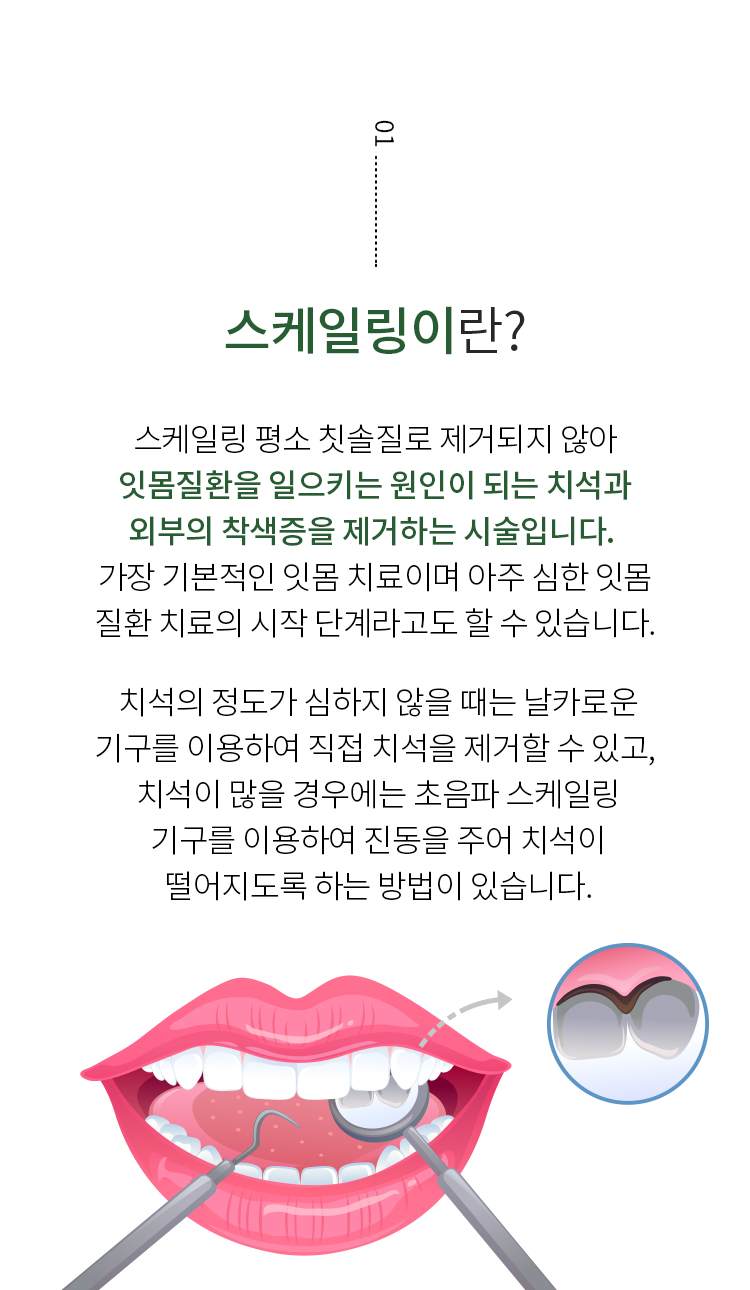 스케일링이란?