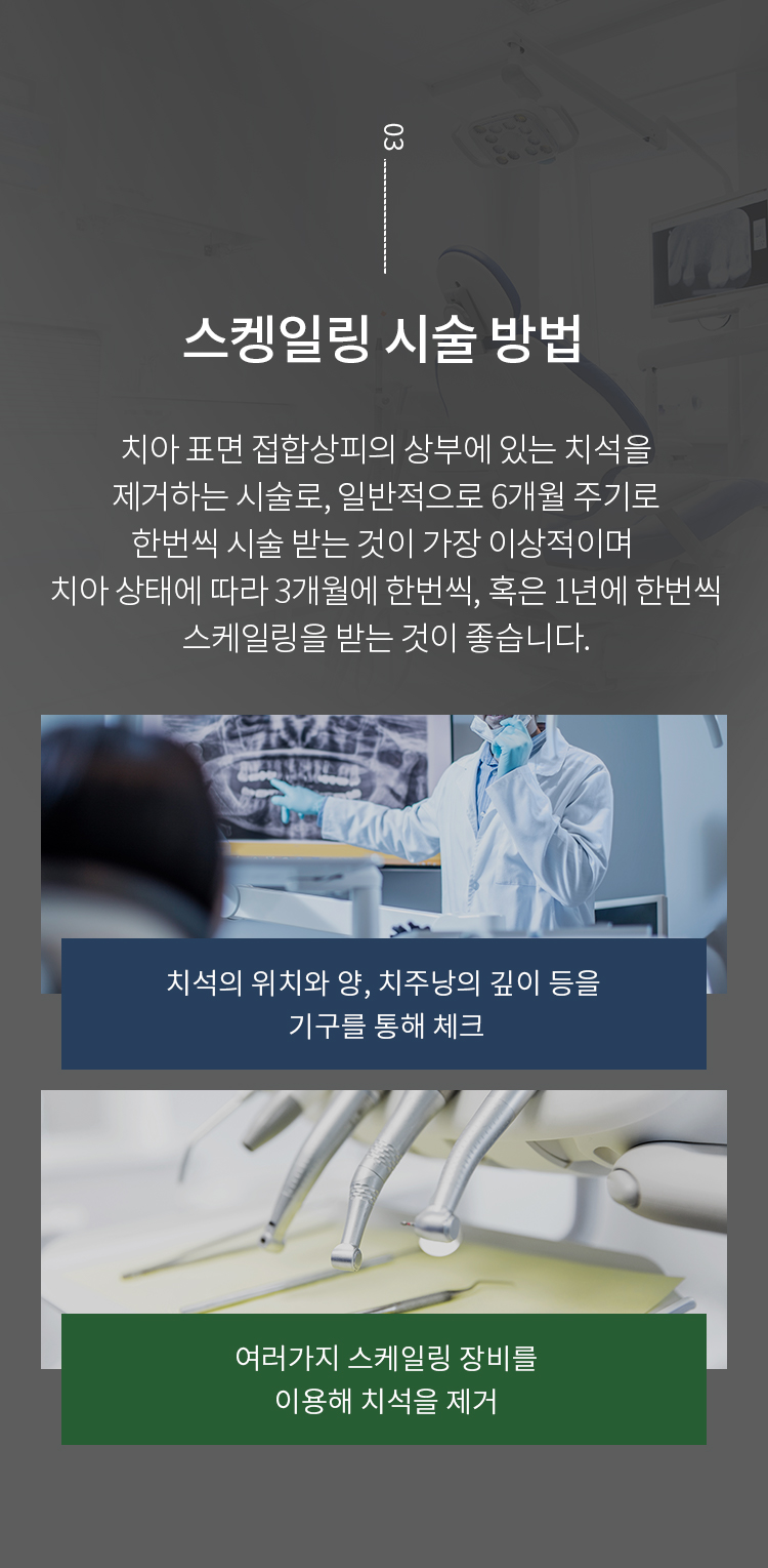 스케일링 시술 방법