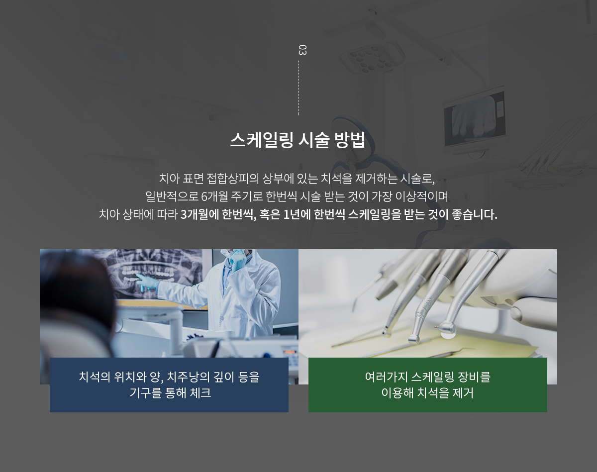 스케일링 시술 방법